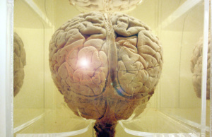 Lack of mental health parity creates ‘walking wounded’ mental health parity