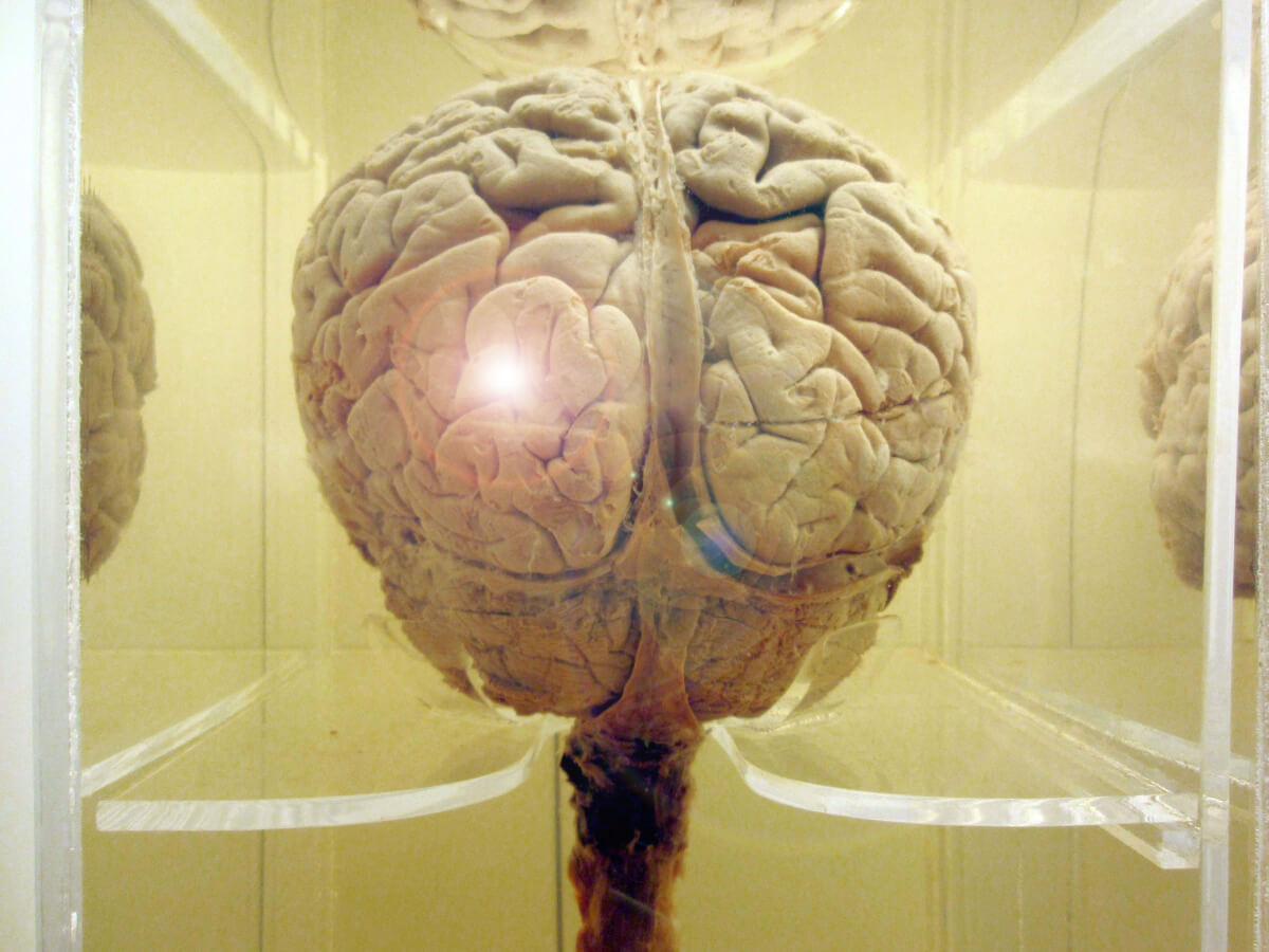 mental health parity