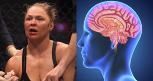 CTE, the UFC and the dark side of combat sports UFC CTE