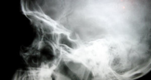 Letter: Death by asphyxiation immoral, inhumane death by asphyxiation