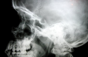 Letter: Death by asphyxiation immoral, inhumane death by asphyxiation