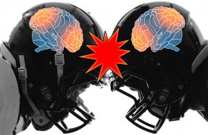 The hazy, frightening world of a sports concussion concussion