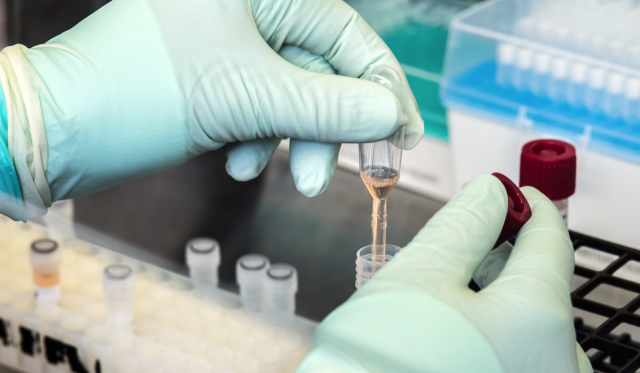 COVID-19 recommendations